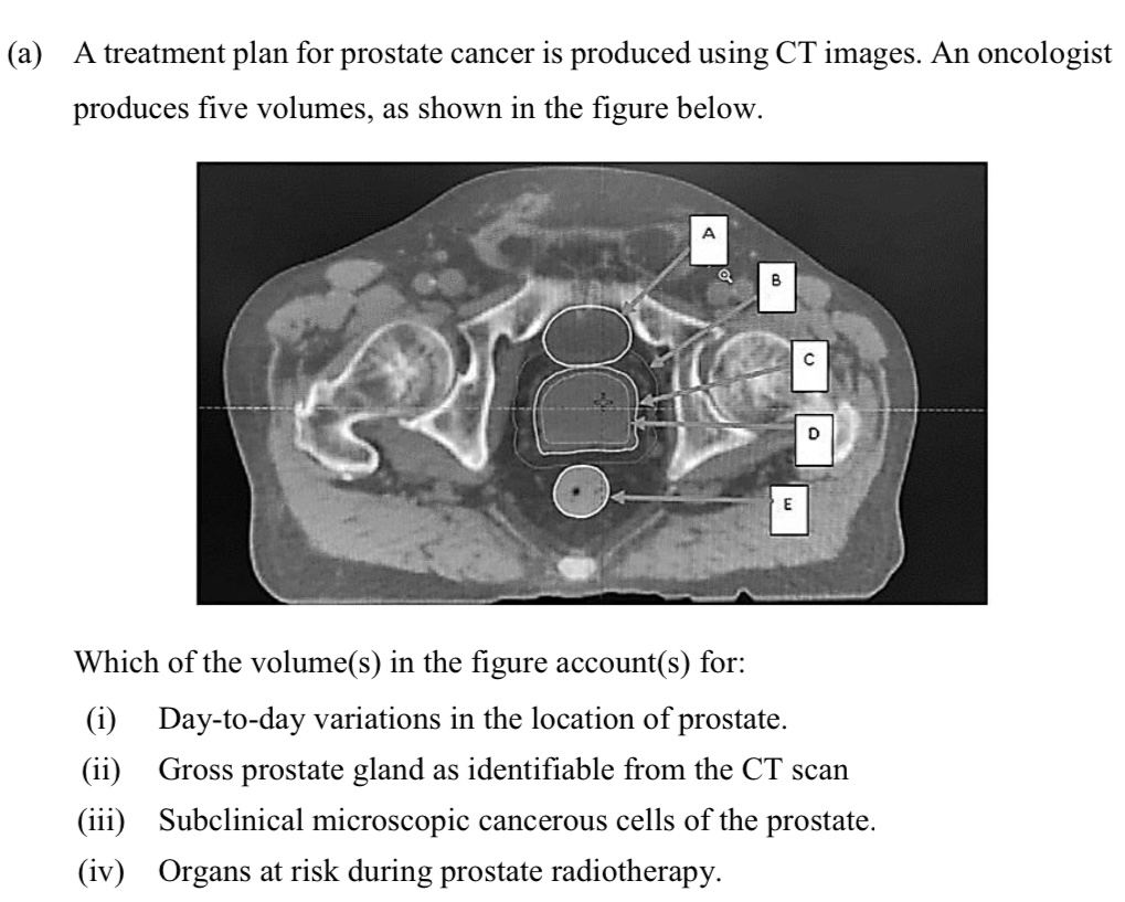 Solved (a) ﻿A treatment plan for prostate cancer is produced | Chegg.com