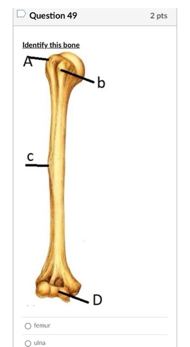 Question 49
ulna