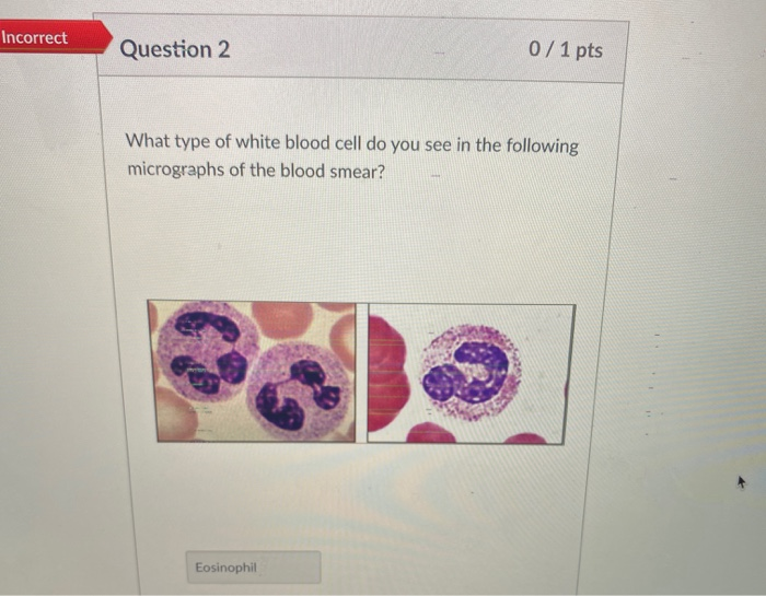 Solved Incorrect Question 2 0/1 pts What type of white blood | Chegg.com