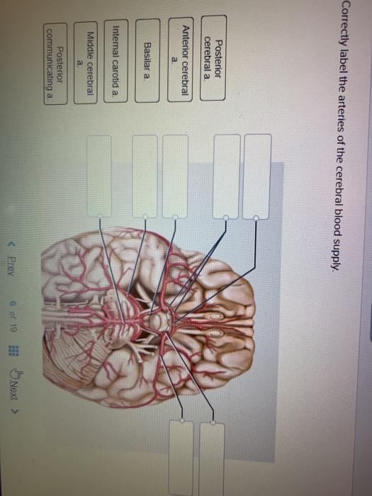 Solved Correctly label the arteries of the cerebral blood