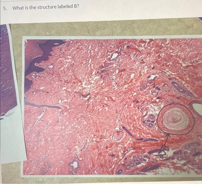Solved 5. What is the structure labeled B?