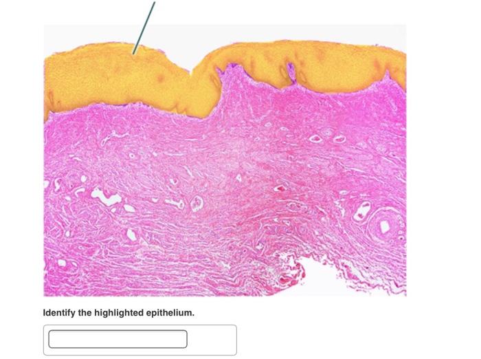 Solved Identify the highlighted epithelium.