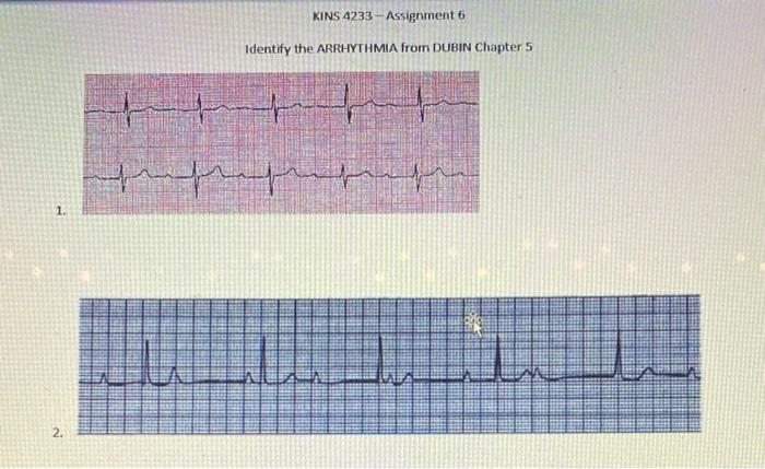 Solved KINS 4233-Assignment 6 Identify the ARRHYTHMIA from | Chegg.com