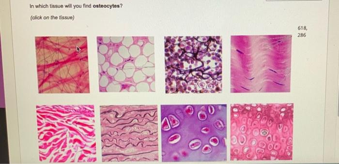 Solved In which tissue will you find osteocytes? (click on | Chegg.com