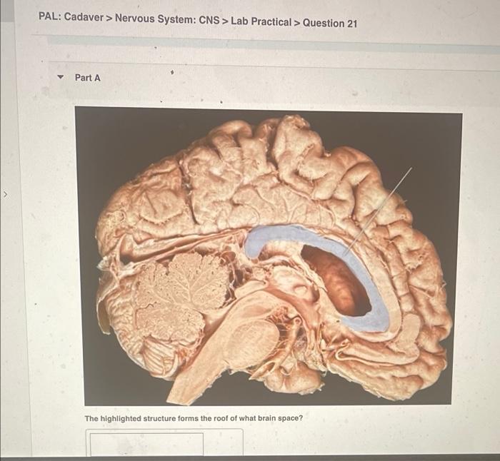 PAL: Cadaver > Nervous System: CNS > Lab Practical > Question 21
Part A
The highlighted structure forms the roof of what brai