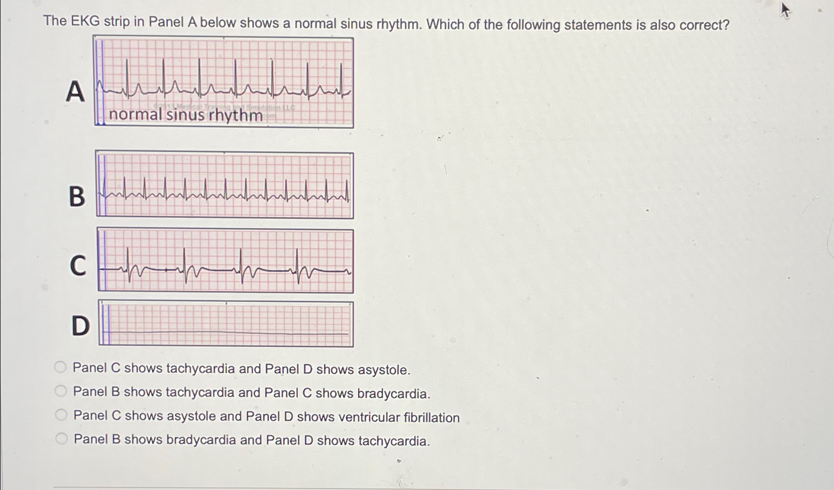 Solved The EKG strip in Panel A below shows a normal sinus | Chegg.com