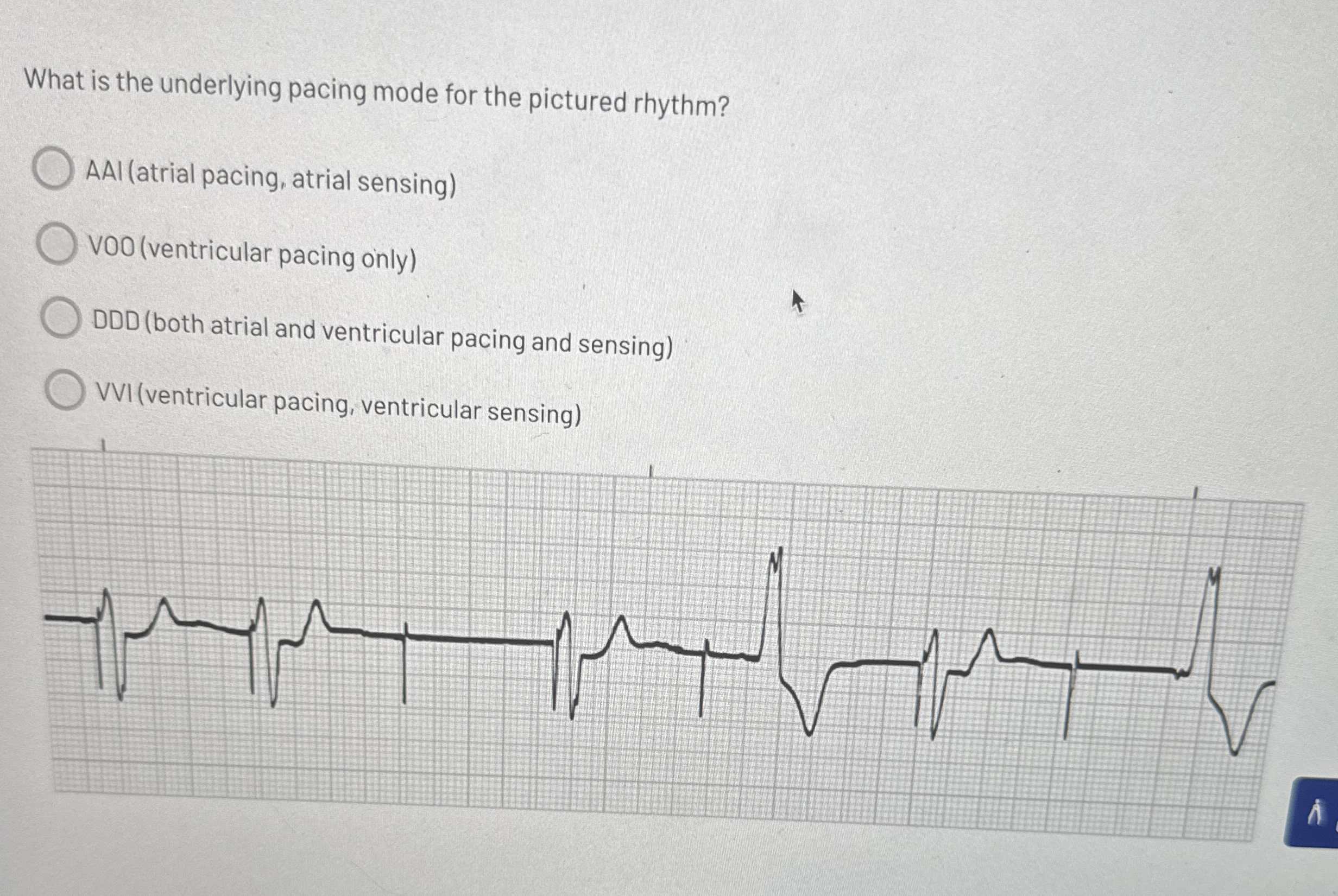 Solved What is the underlying pacing mode for the pictured | Chegg.com