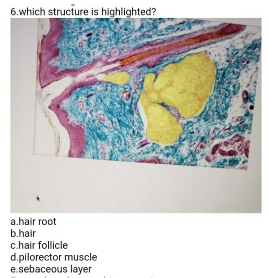 Solved 6.Which Structure Is Highlighted? A.hair Root B.hair | Chegg.com Solved 6.Which Structure Is Highlighted? A.hair Root B.hair | Chegg.com