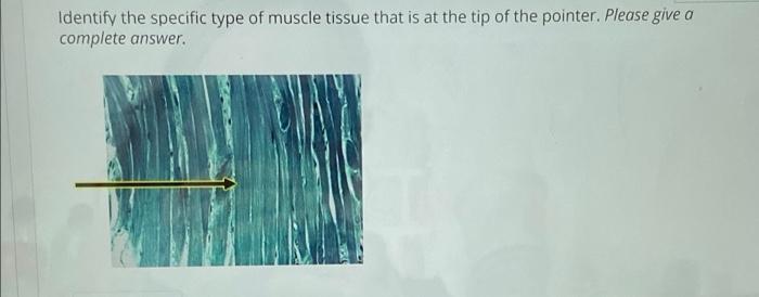 Solved Identify the specific type of muscle tissue that is | Chegg.com
