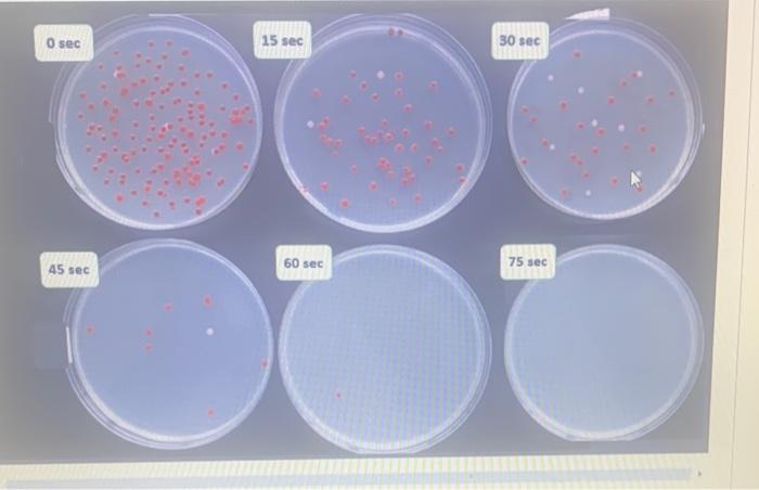 Solved UV Light Effects on Bacterial Cells Serratia | Chegg.com