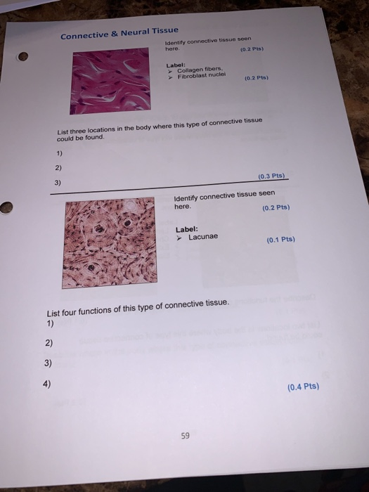 Solved Connective & Neural Tissue Identify Connective Tissue | Chegg.com