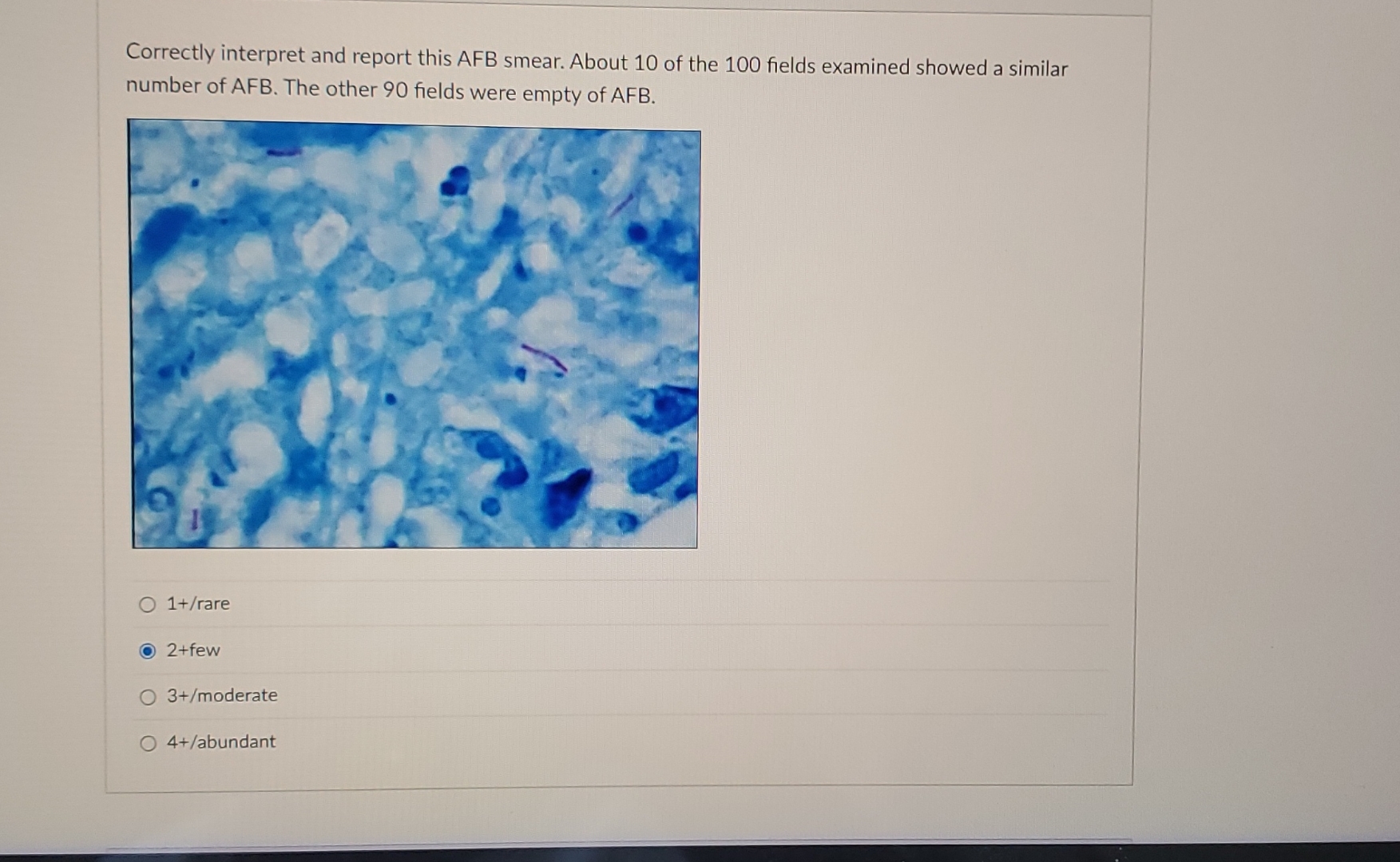 Afb Interpretation Form.pdf Solved Correctly interpret and report this AFB smear. About | Chegg.com