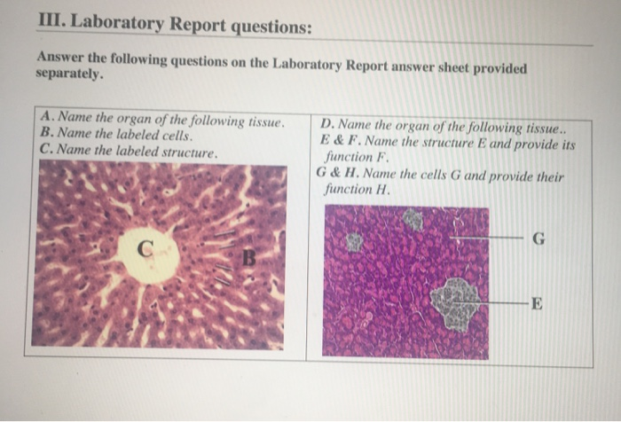 Solved III. Laboratory Report questions: Answer the | Chegg.com