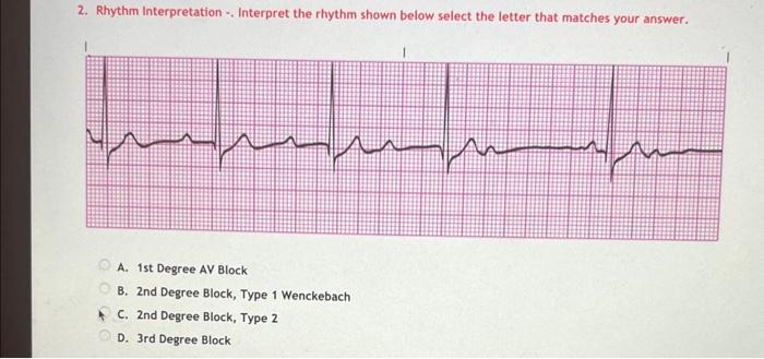 Solved 1. Rhythm Interpretation -. Interpret the rhythm | Chegg.com