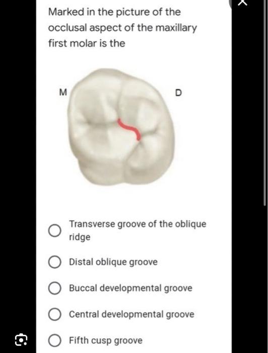 Solved Marked in the picture of the occlusal aspect of the