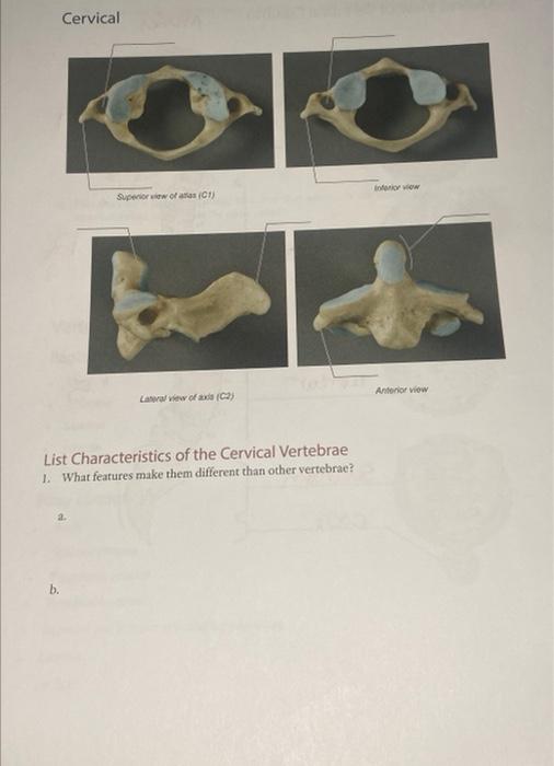 List Characteristics of the Cervical Vertebrae
1. What features make them different than other vertebrae?
2.
b.