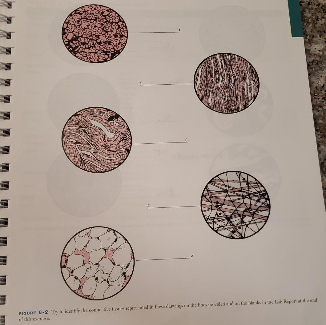 Solved Try To Identify The Connective Tissues Represented Chegg