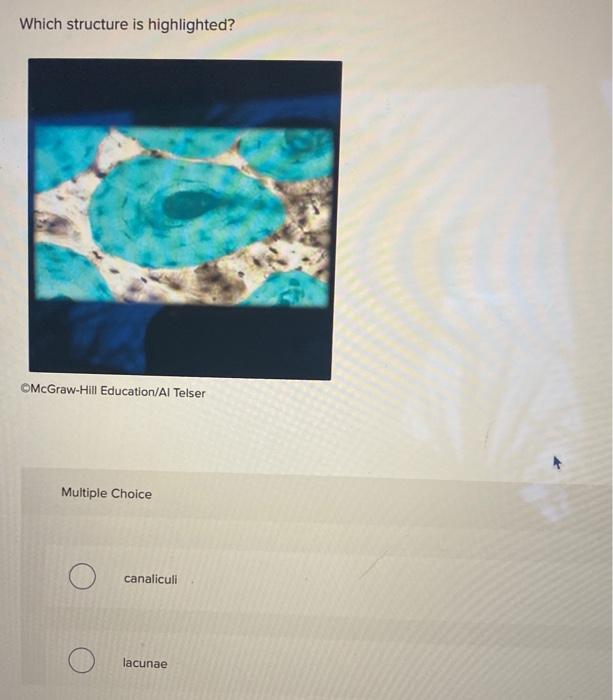 Which structure is highlighted?
OMcGraw-Hill Education/Al Telser
Multiple Choice
canaliculi
lacunae