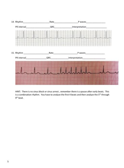 Solved 14. Rhythm Rate P waves PR interval Qks | Chegg.com