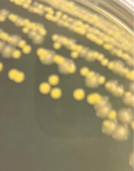 Solved identify the two microorganismsbig colonies: gram | Chegg.com