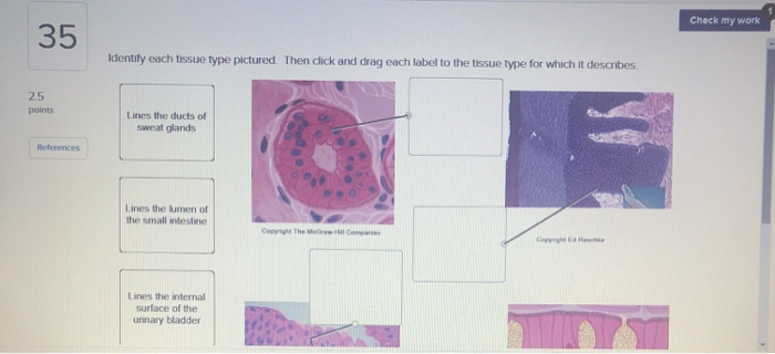 Solved Check my work 35 Identify each tissue type pictured. | Chegg.com