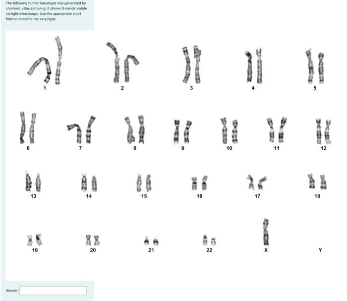 Solved The Following Human Karyotype Was Generated By | Chegg.com