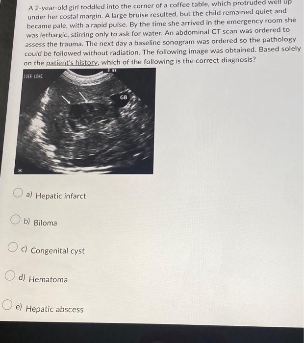 Solved A 2-year-old girl toddled into the corner of a coffee | Chegg.com