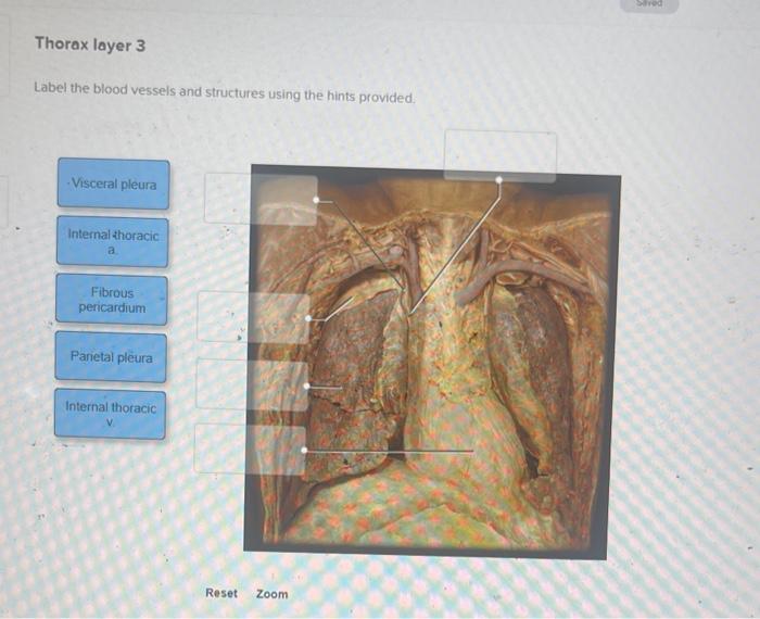 Solved Label the blood vessels and structures using the