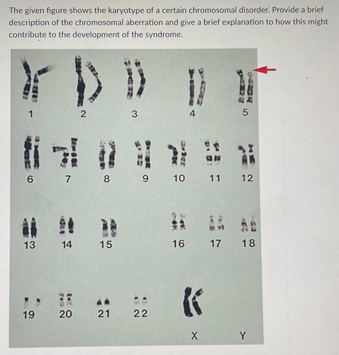 Solved The given figure shows the karyotype of a certain | Chegg.com