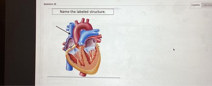Solved Name the labeled structure. | Chegg.com