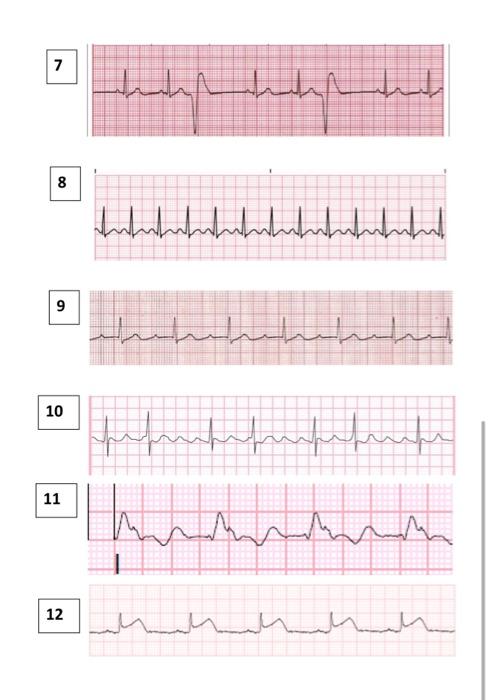 Solved Label two complete heart beats (two wave cycles) and | Chegg.com