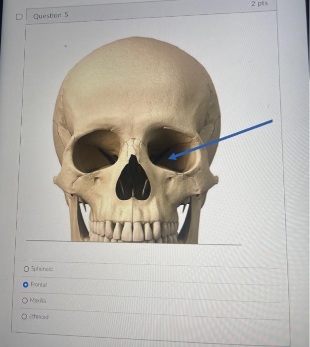 Sphenoid
Frontal
Maxilla
Ethmoid