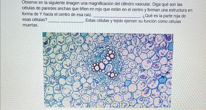 Observe en la siguiente imagen una magnificación del cilindro vascular. Diga qué son las cẻlulas de paredes anchas que tiñen