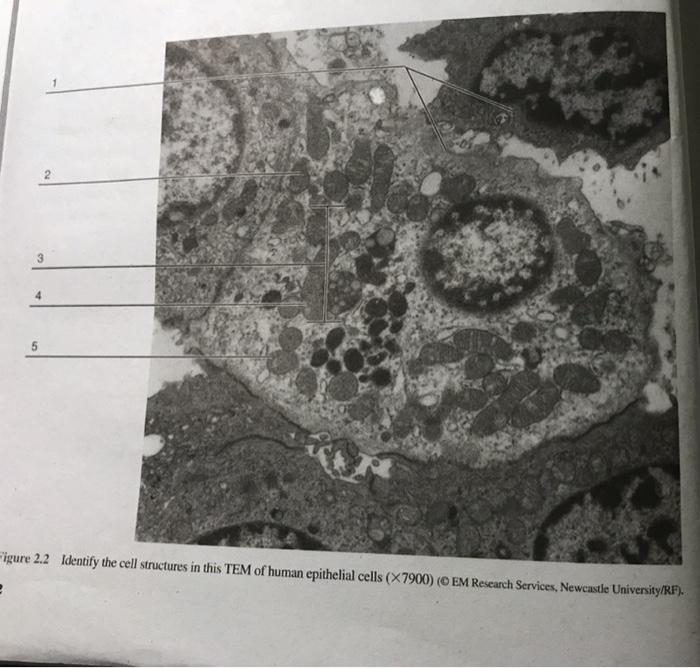 5 Figure 2.2 Identify the cell structures in this TEM | Chegg.com
