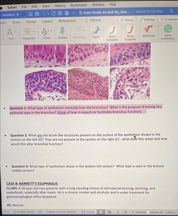 Solved CASE A: SQUAMOUS CELL CARCINOMA OF THE LUNG CC/HPI: A | Chegg.com