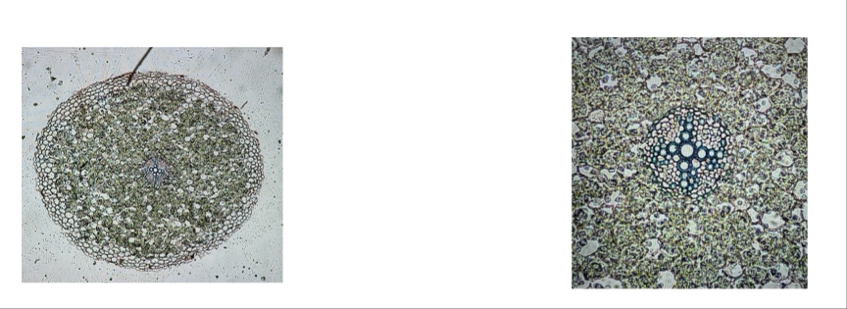 Solved This is a cross section of a Ranunculus root | Chegg.com
