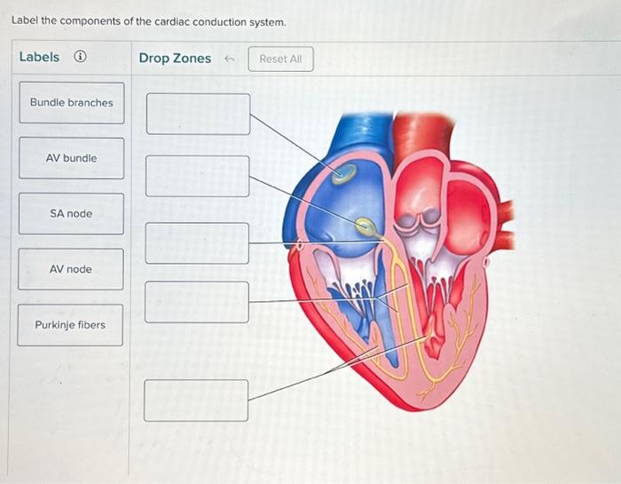 Solved Correctly label the following blood vessels of the | Chegg.com