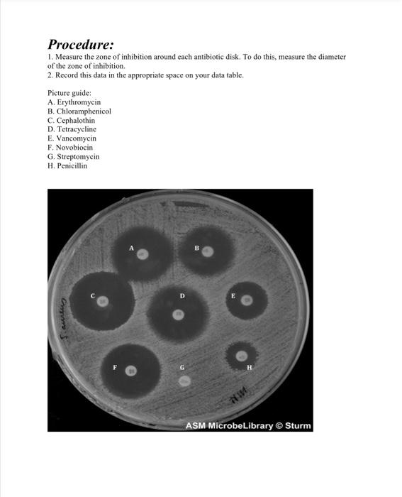 Solved Question: Using the Kirby-Bauer disk-diffusion | Chegg.com