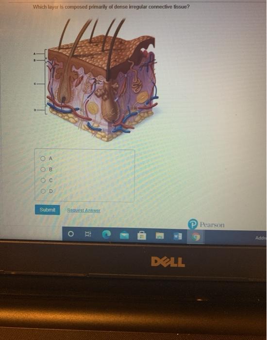 Solved Which layer is composed primarily of dense irregular | Chegg.com