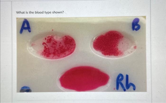 what-is-the-blood-type-shown-chegg