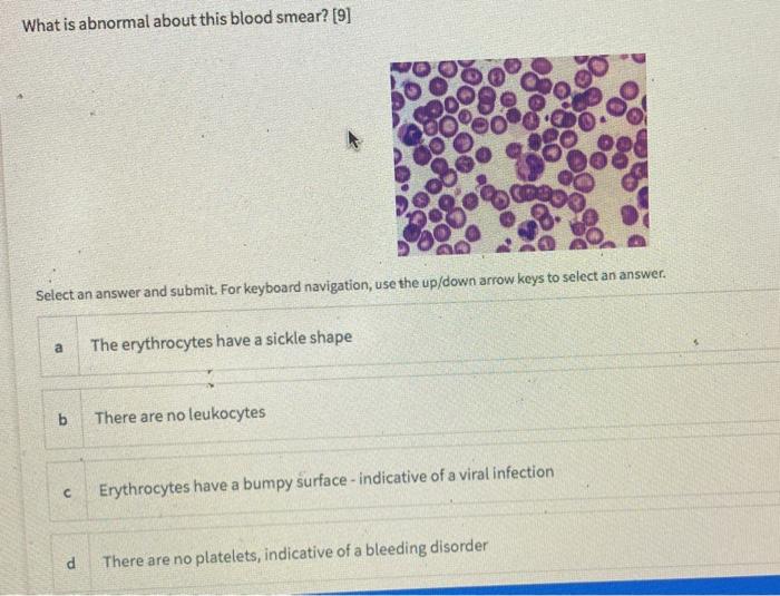 Does your body show any signs of thick blood? 🩸🩸🩸 (Checkout slide 3 for  a list of clues!) Thick bloodgoopy blood that runs