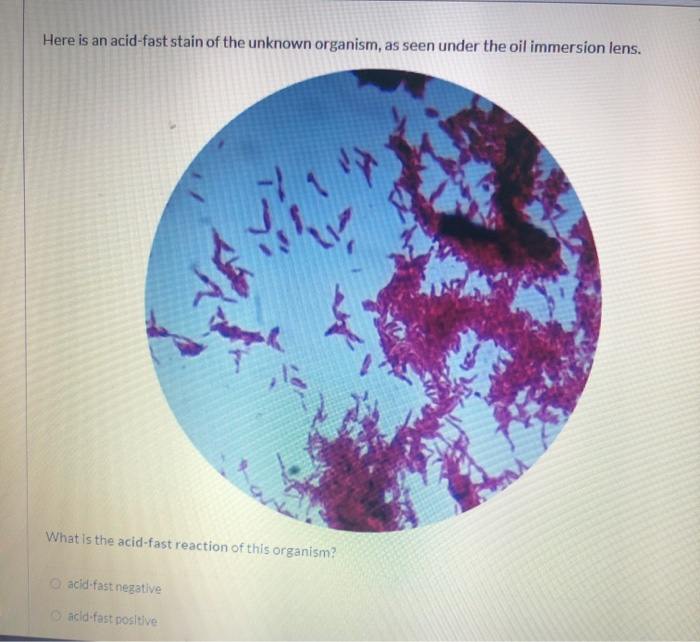 Solved Here is the Gram stain of the unknown organism, as | Chegg.com