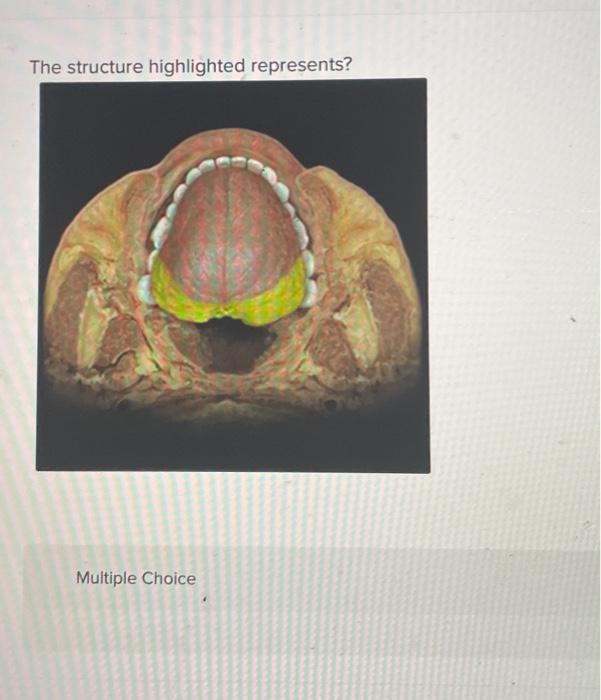 Solved The structure highlighted represents? Multiple | Chegg.com