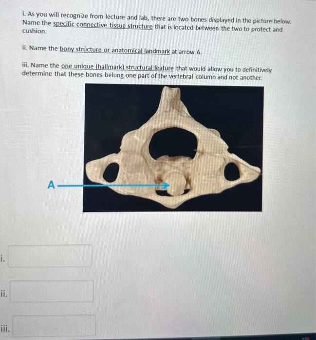 Solved i. Name the anatomical landmark (bony structure) at | Chegg.com