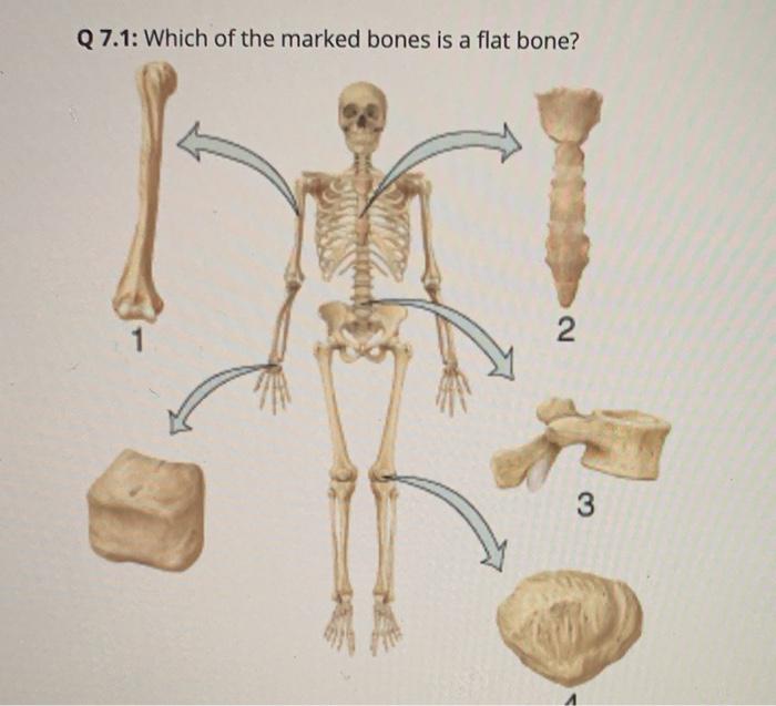 Q 7.1: Which of the marked bones is a flat bone? foto | Chegg.com