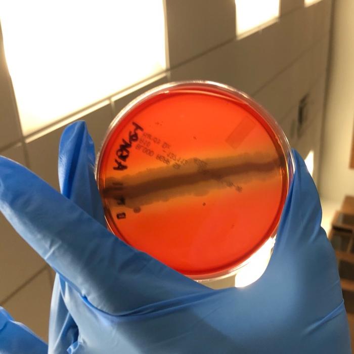 Solved this is a hemolysis /blood agar plate is it beta or | Chegg.com