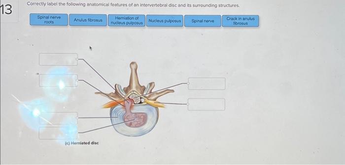 Solved Correctly Label The Following Anatomical Features Chegg Com