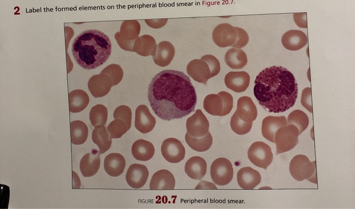 Solved 2 Label the formed elements on the peripheral blood | Chegg.com