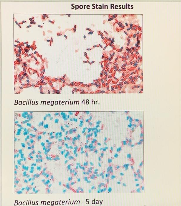 bacillus megaterium gram stain positive