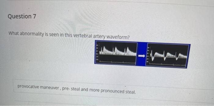 Solved Question 7 What abnormality is seen in this vertebral | Chegg.com